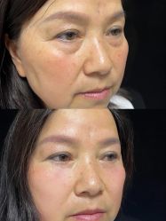 -深圳艺星医疗美容医院