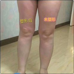 -华脉瘦身