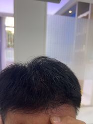 点击看大图 -雍禾植发