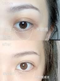 -SKINIST丽铂医疗美容