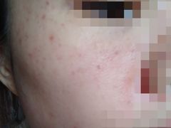 -重庆医科大学附属第一医院(本部)