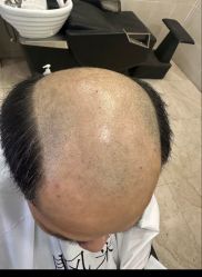 -唐风采假发补发定制