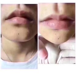 -西安现代妇产医院医疗美容