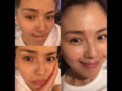 -苗方清颜痘肌研究所