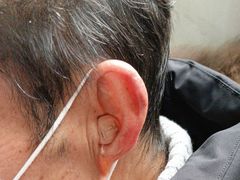 -自然之声助听器·呼吸机(公园路店)