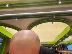 -大麦微针植发全国连锁