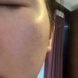 -洁铭新加坡医美