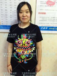 -维纳斯专业减肥