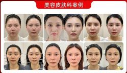 -Yestar艺星整形美容医院