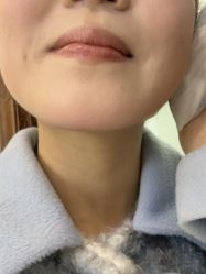 -长沙雅美医疗美容医院