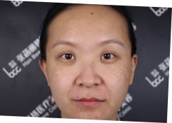 体验前-联合丽格·张菡丽格医疗美容