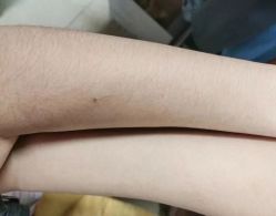 -苗方清颜专业祛痘连锁机构