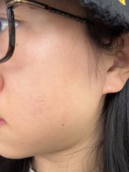 体验前-广州美莱医疗美容医院