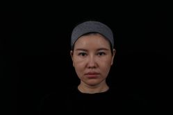 体验前-深圳米兰柏羽医疗美容医院