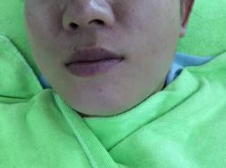 -苗医生草本科技祛痘