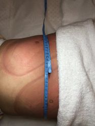 -肥三针腧穴瘦身馆