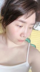 体验后-Yestar 嘉兴艺星医疗美容医院