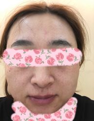 -北京爱育华医院-医疗美容科