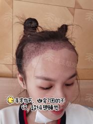 -雍禾植发全国连锁