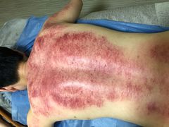 -张钰强中医正骨推拿连锁(唐家人才公寓店)