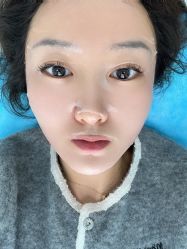 体验后-繁星轻医美连锁