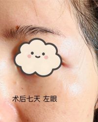 体验后-深圳鹏爱秀琪医疗美容医院