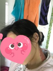 点击看大图 刮痧-本真坊美容美体沙龙