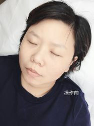 -西施无菌半永久纹绣眉眼影唇轻增发纹发际线