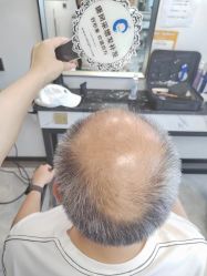 -唐风采假发补发定制