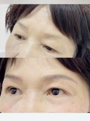 -MISS STAR·半永久纹眉·发际线·美瞳线