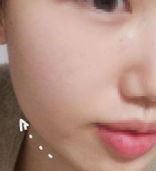 -佛山艺美医疗美容·整形·美肤·塑形