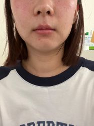 -海涛医疗美容·面部抗衰·注射美鼻