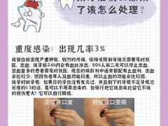 -团圆口腔·种植中心(锦江院区)