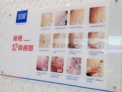 -SOR索尔祛痘·面部肌肤科学管理