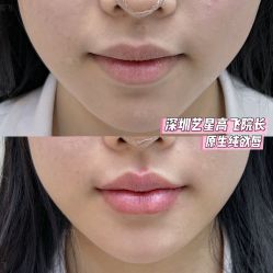 -深圳艺星医疗美容医院