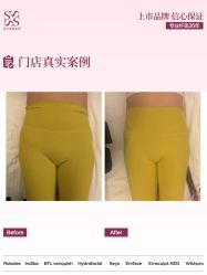 点击看大图 -Fundi张玉珊修身堂·indiba·BTL科技瘦身