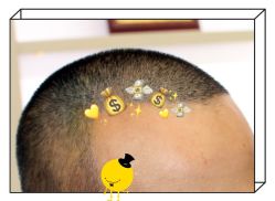 -大麦微针植发全国连锁