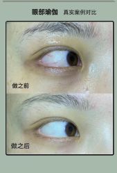 -AiCure 埃可儿·韩国医学皮肤管理
