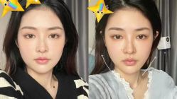 -Yestar 嘉兴艺星医疗美容医院