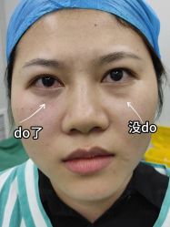 -广州健丽·去眼袋医疗美容机构