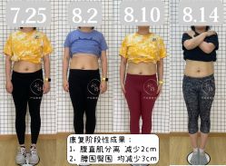点击看大图 -初练产后康复