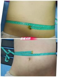 -清媚减肥瘦身纤体