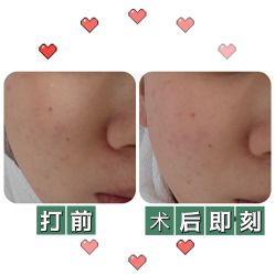体验前-坤如玛丽·医疗美容中心