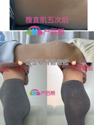 点击看大图 -产后帮产后修复(首城国际店)