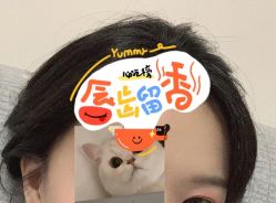 -大麦微针植发全国连锁