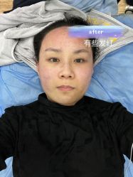 -郑州米兰柏羽集美医疗美容医院