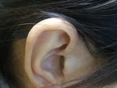 -自然之声助听器·呼吸机(公园路店)