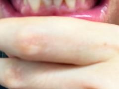 -微笑牙科口腔(三亚迎宾院区)