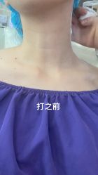 体验前-深圳阳光医疗美容医院·旗舰店