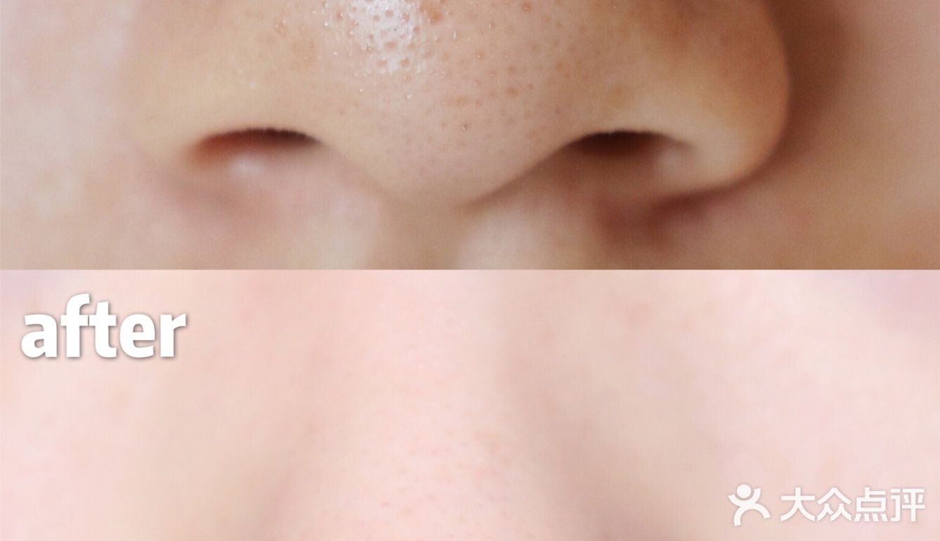 我的夏季专宠👉🏻在家也能用的黑科技